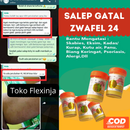 Salep Zwafel 24 Original BPOM Obat Kulit 